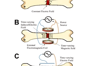 Cellular Conversations: Signal-Driven Regeneration – Advances in Orthopedic Healing, Electrical Stimulation