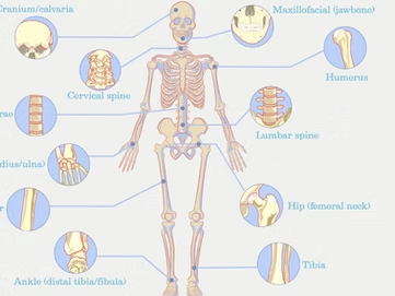 From Tiny Bones to Big Breaks: A Primer on Fracture Recovery
