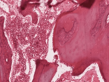 The Blueprint for Bones: Building with Proteoglycans