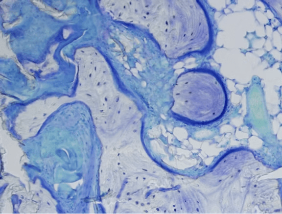 Proteoglycan Errors in Embryonic Bone Development: A Closer Look