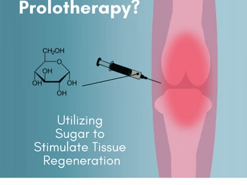 Prolotherapy and the Use of Sugars in Orthopedics